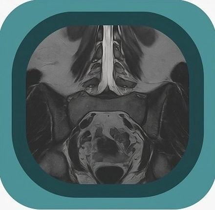 MRI lumbosacral plexus anatomy icon